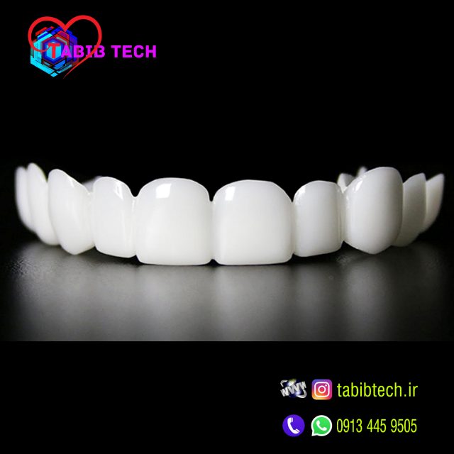 tabibtech.ir لمینت متحرک دندان snap on smile