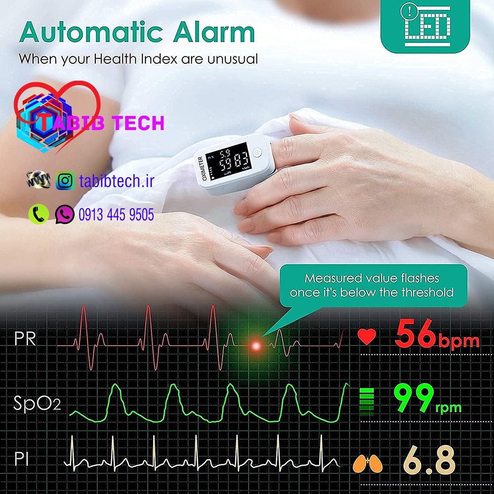 پالس اکسیمتر ییمی لایف Yimi Life YM101 - طبیب تِک TabibTech