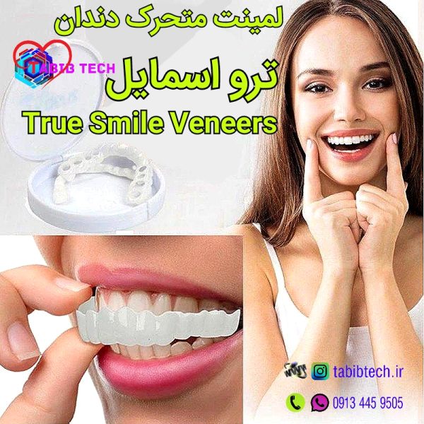 tabibtech.ir لمینت متحرک ترو اسمایل True Smile Veneers