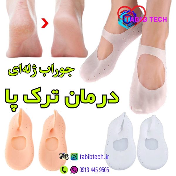 tabibtech.ir جوراب درمان ترک پا