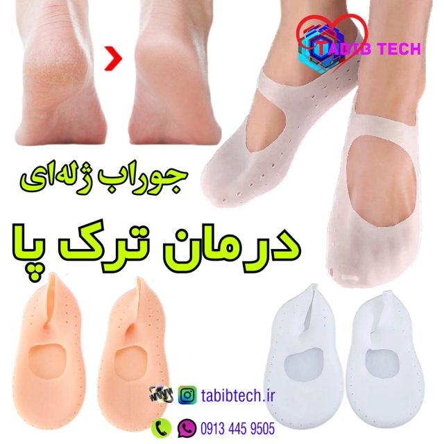 tabibtech.ir جوراب درمان ترک پا