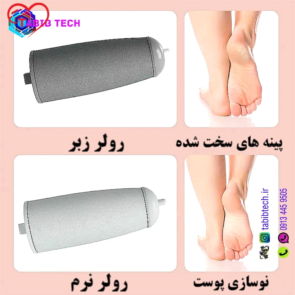 tabibtech.ir سوهان سنگ پا برقی و شارژی